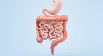 Image representing Hirschsprung’s Disease: What You Need to Know